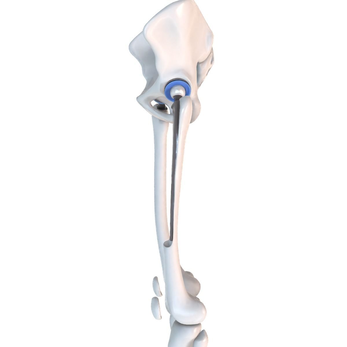 Hip replacement implant installed in the pelvis bone 3D model_16