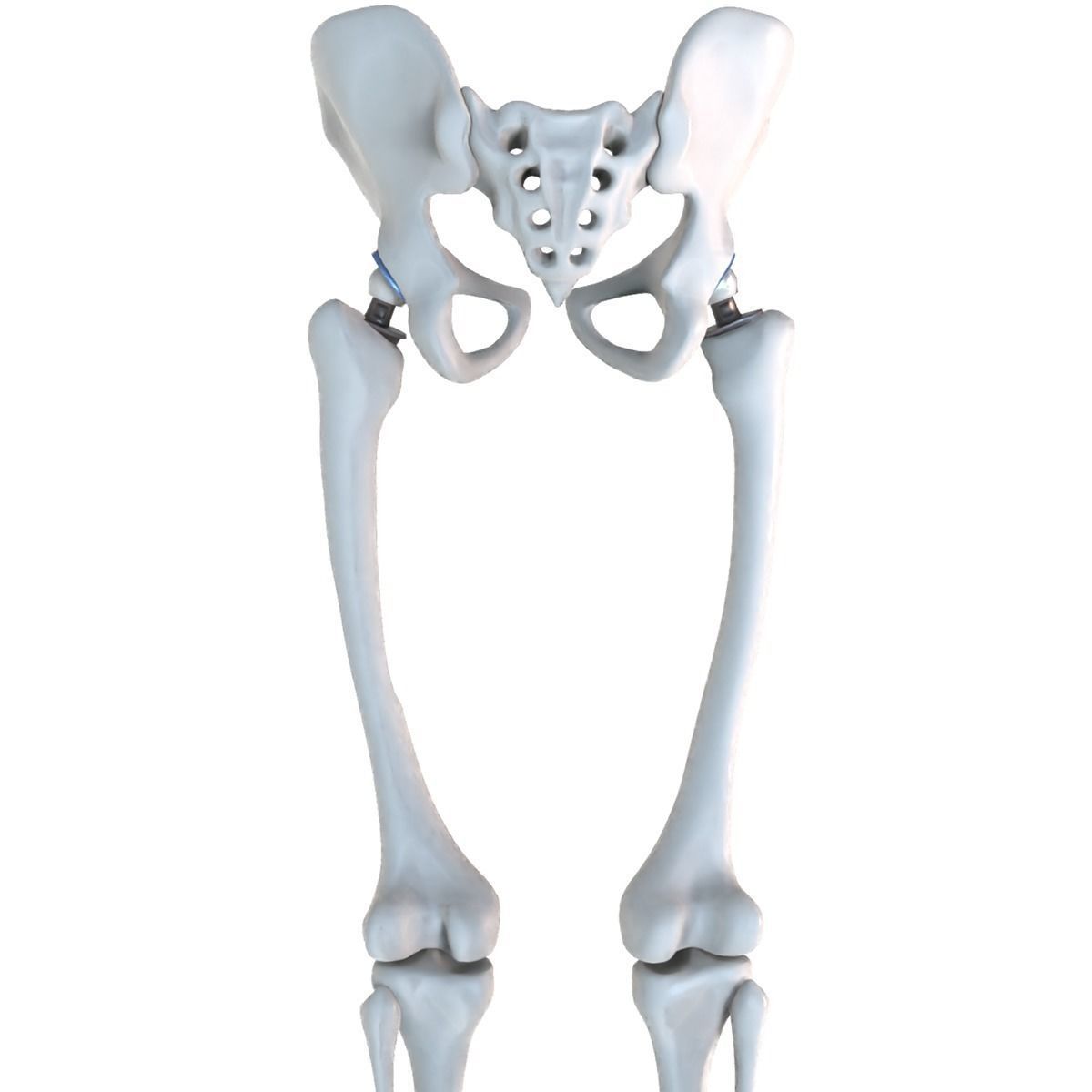 Hip replacement implant installed in the pelvis bone 3D model_12