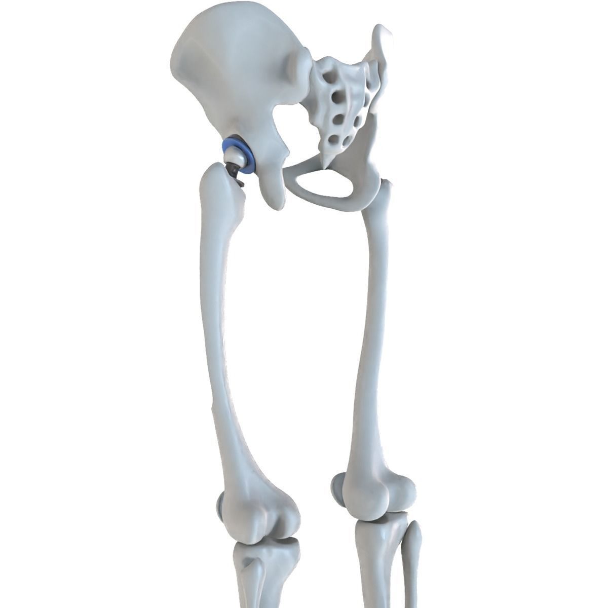 Hip replacement implant installed in the pelvis bone 3D model_13