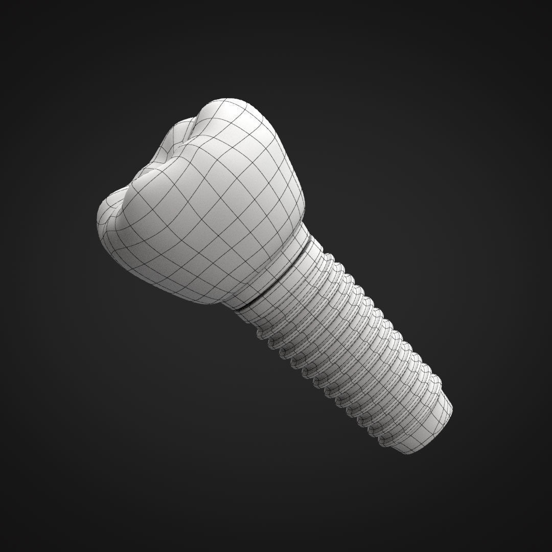 Tooth Implant 3D model_26