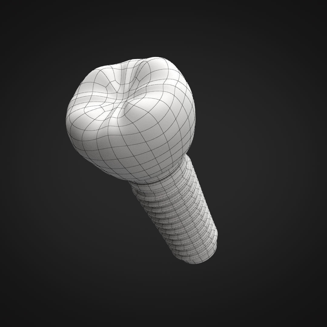 Tooth Implant 3D model_23