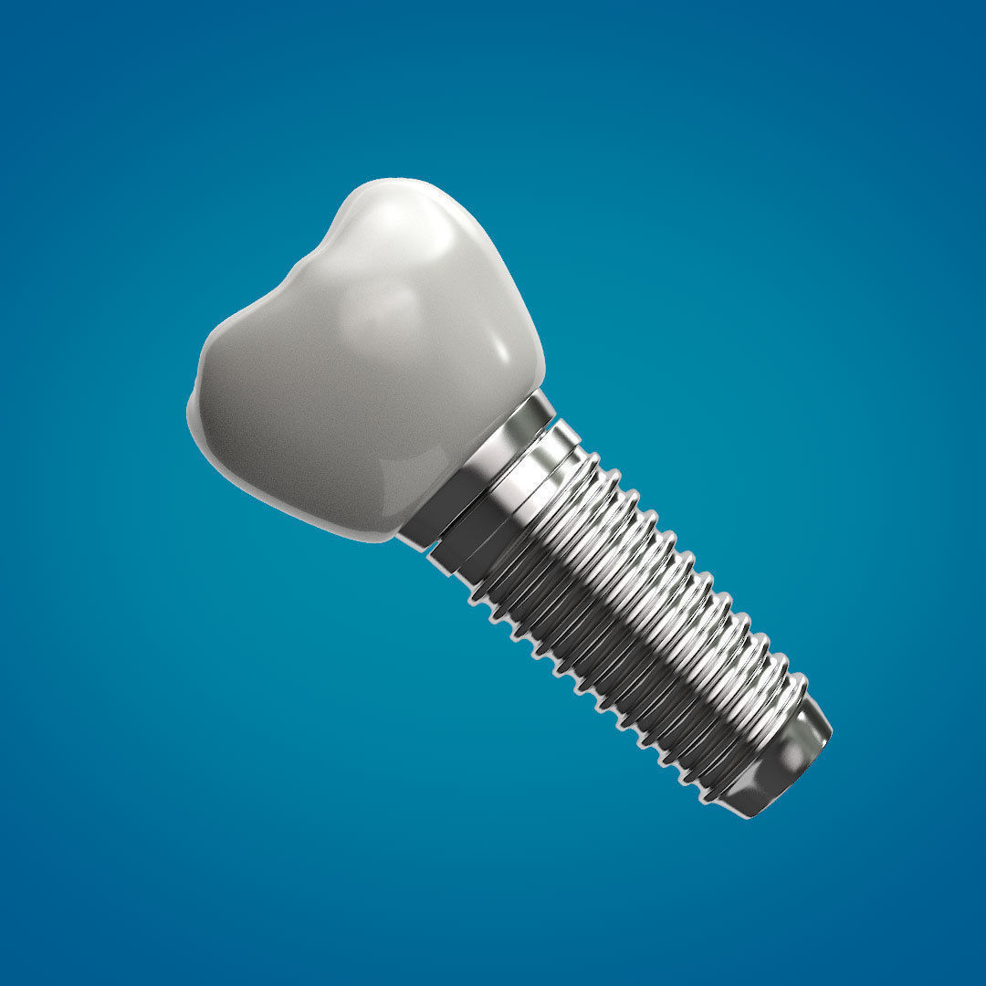 Tooth Implant 3D model_7