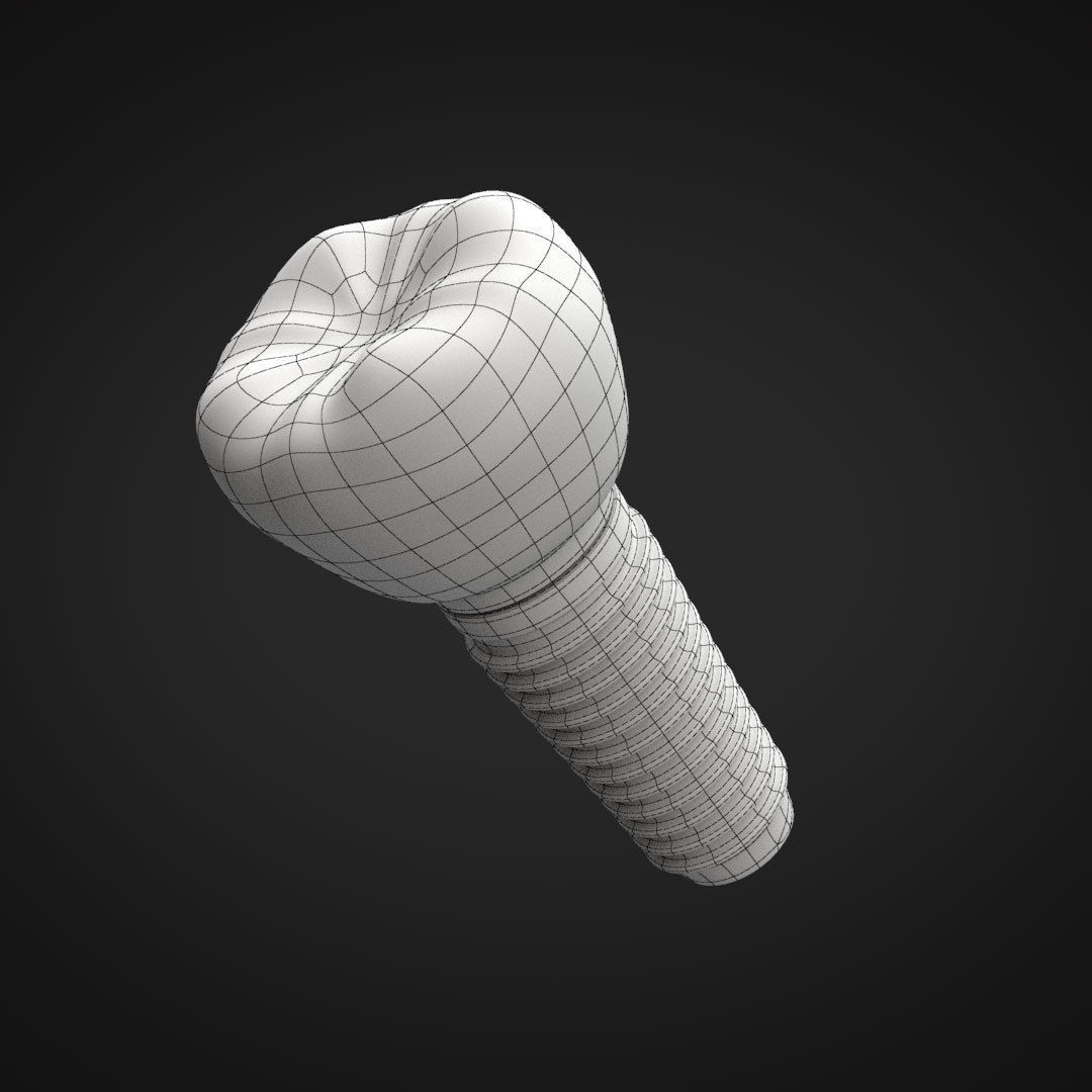 Tooth Implant 3D model_24