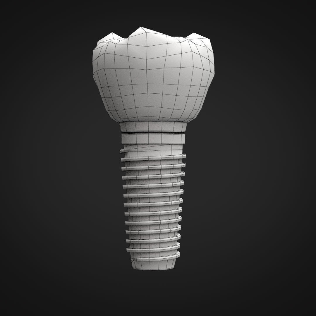 Tooth Implant 3D model_12