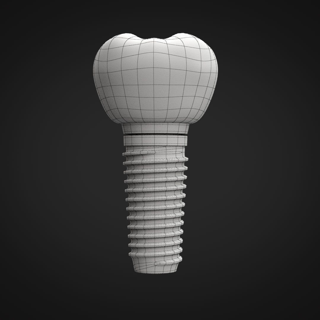 Tooth Implant 3D model_21