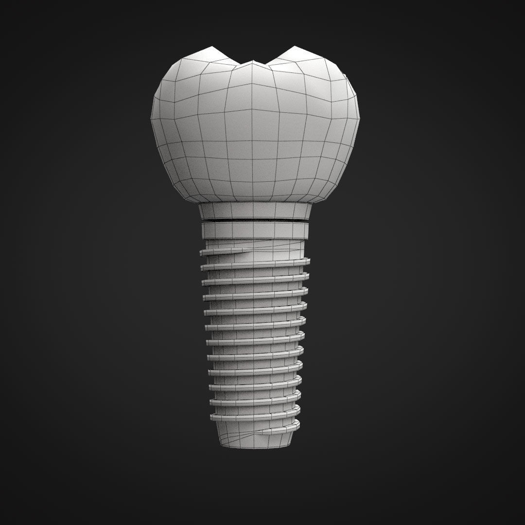 Tooth Implant 3D model_11
