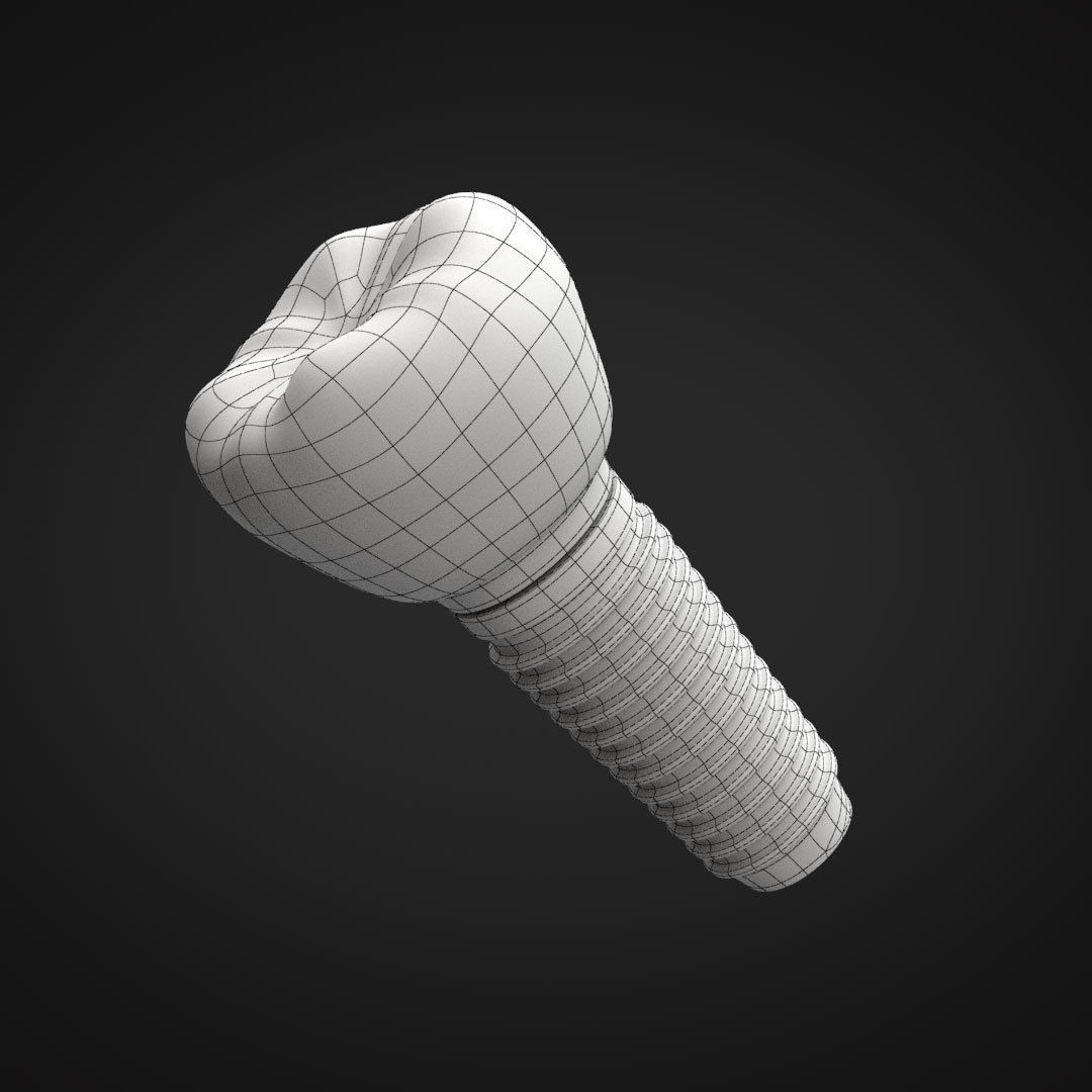 Tooth Implant 3D model_25