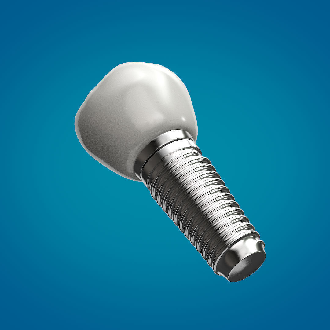 Tooth Implant 3D model_8