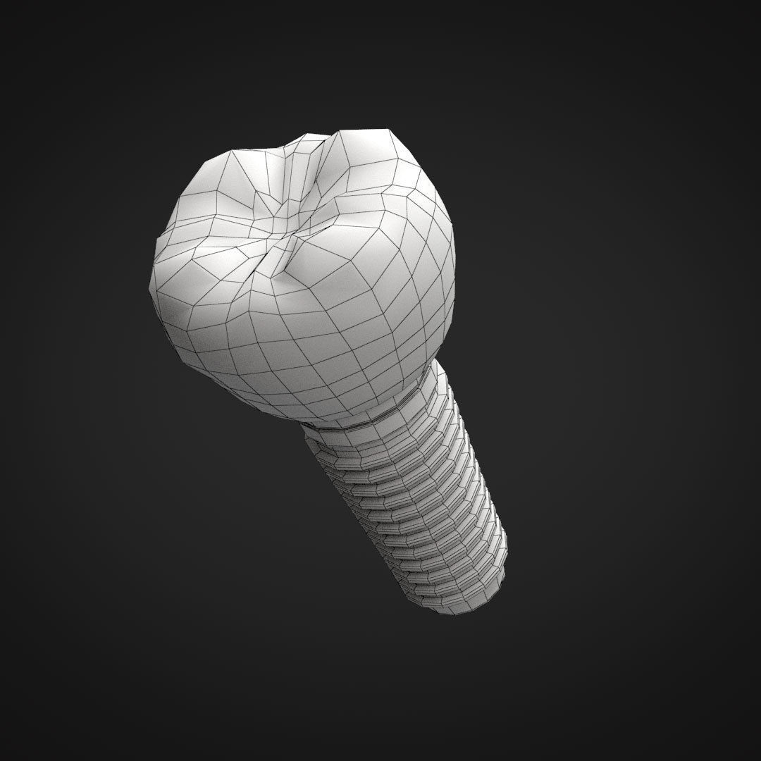 Tooth Implant 3D model_13