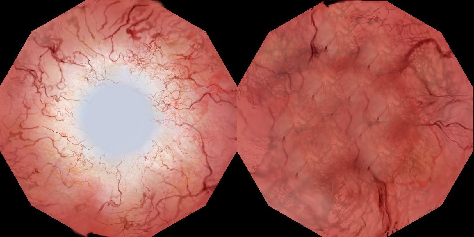 Blue eyes 3D model_4