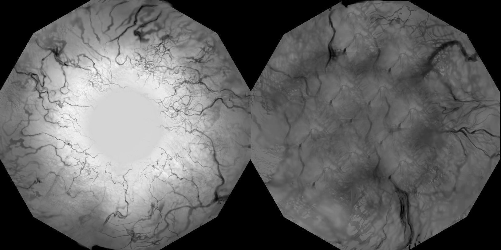 Blue eyes 3D model_3