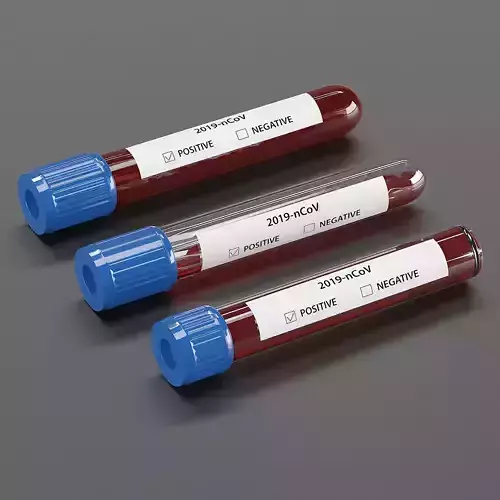 CORONAVIRUS test tubes 3 typies