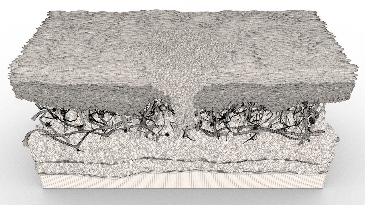 Skin Cancer Cells 3D model_22