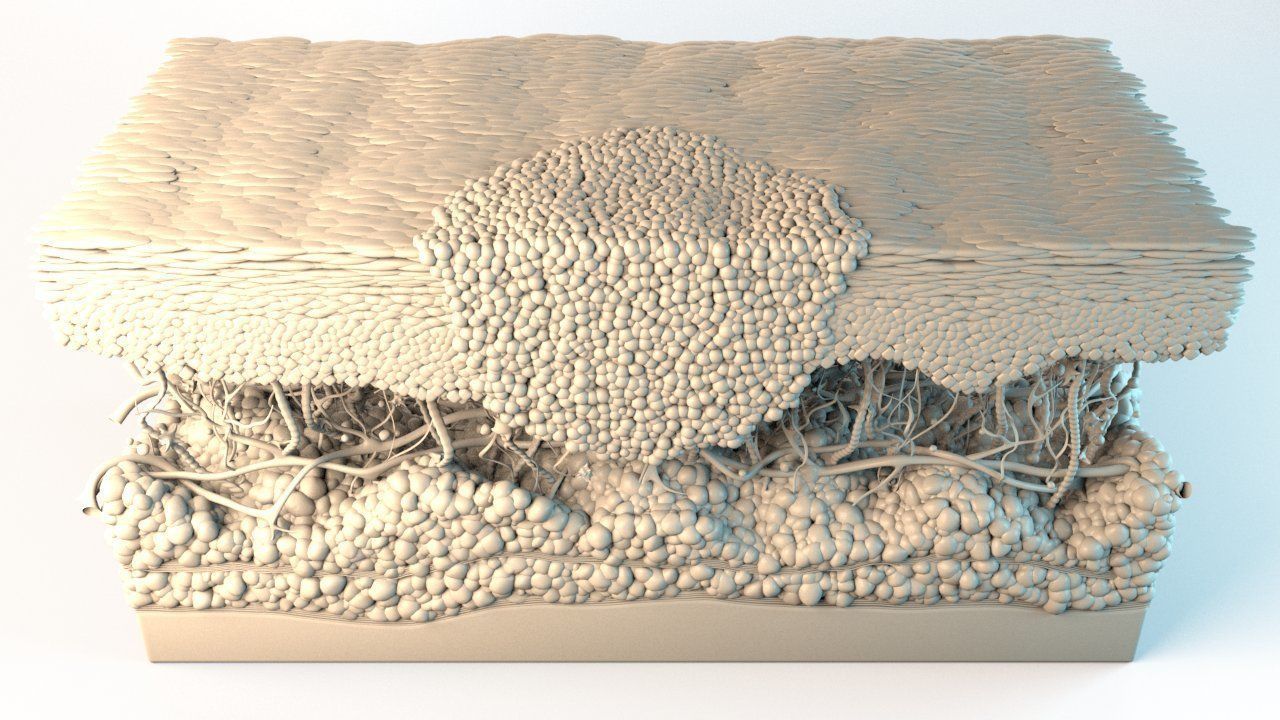 Skin Cancer Cells 3D model_14