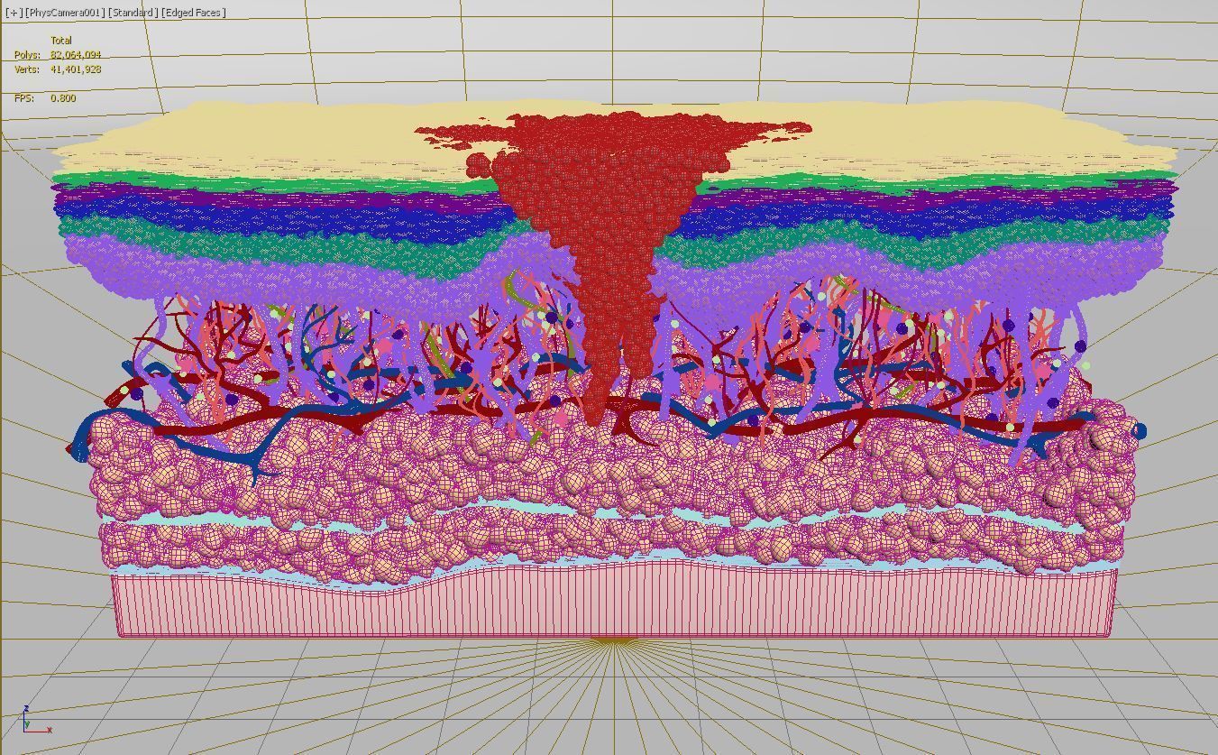 Skin Cancer Cells 3D model_12