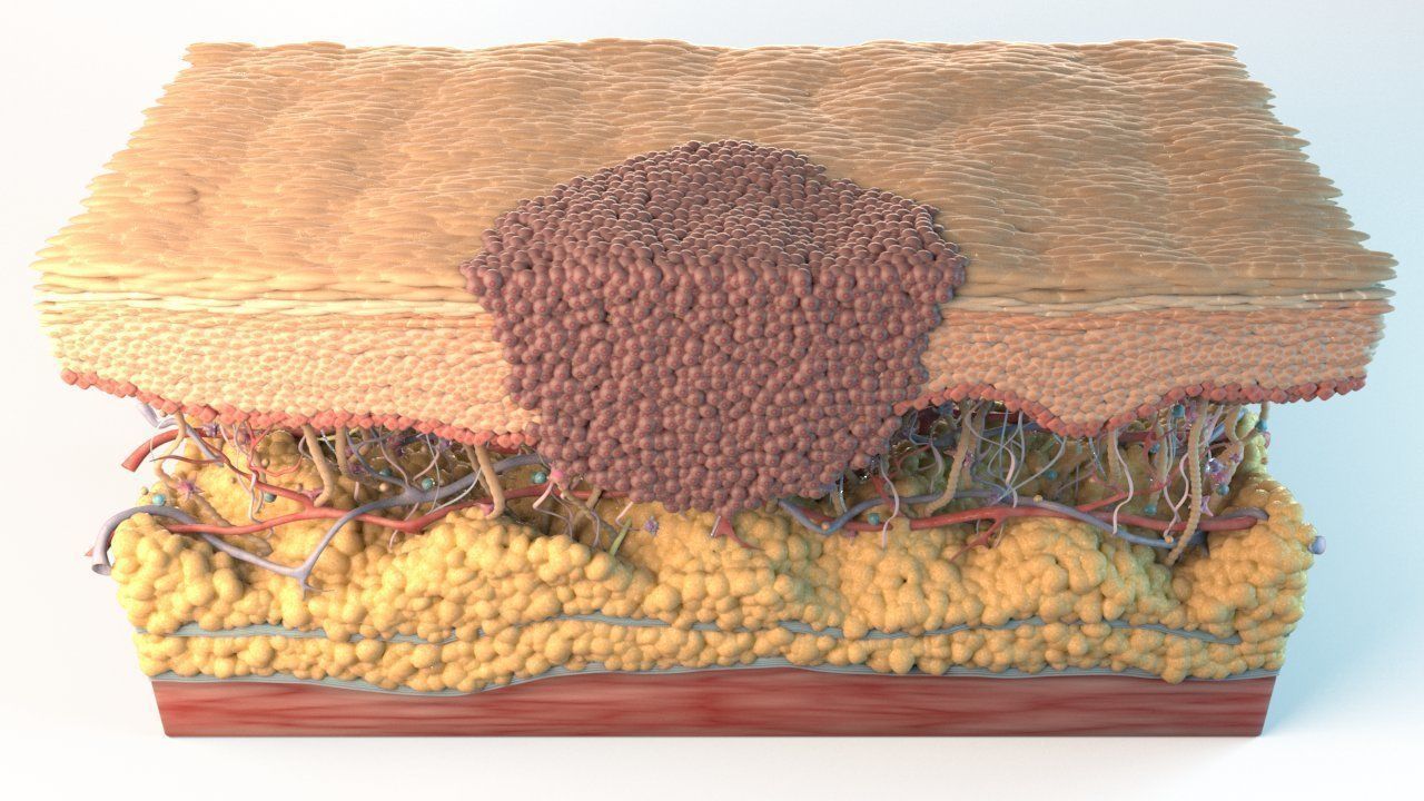 Skin Cancer Cells 3D model_3