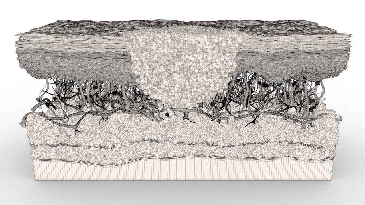 Skin Cancer Cells 3D model_13