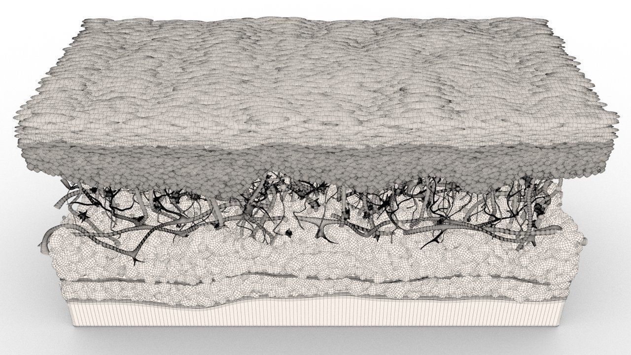 Skin Cancer Cells 3D model_29