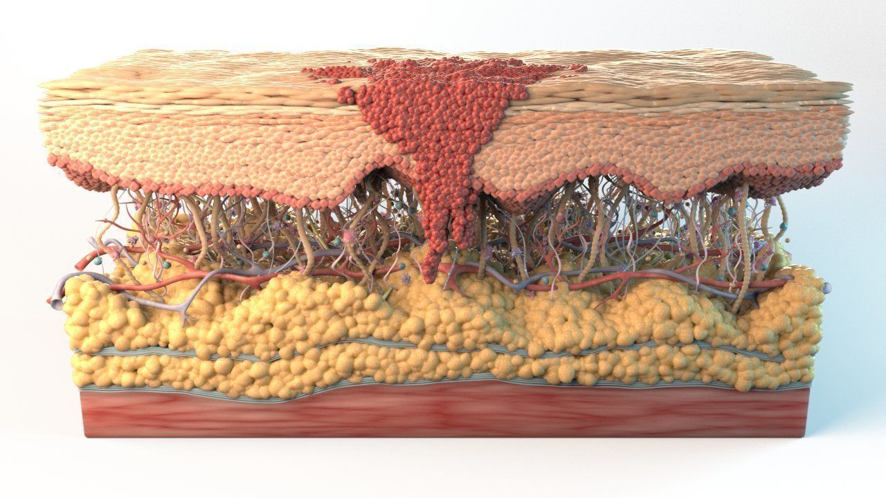 Skin Cancer Cells 3D model_1
