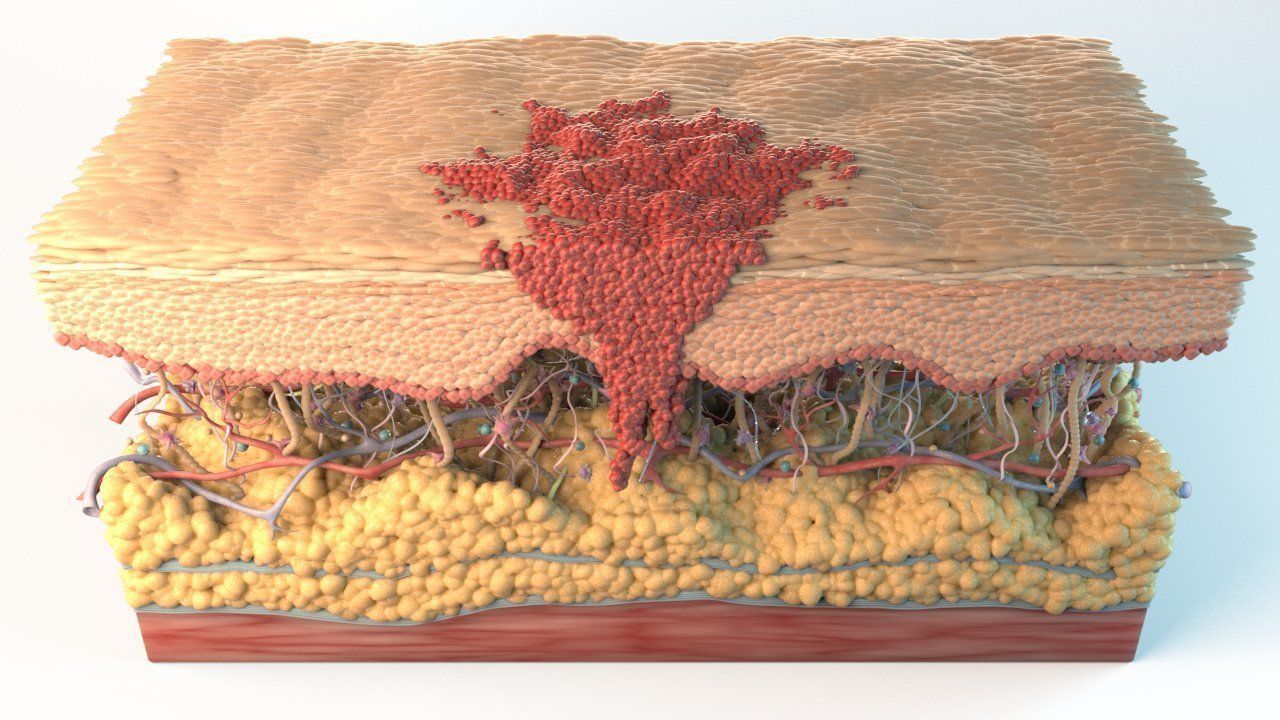 Skin Cancer Cells 3D model_18