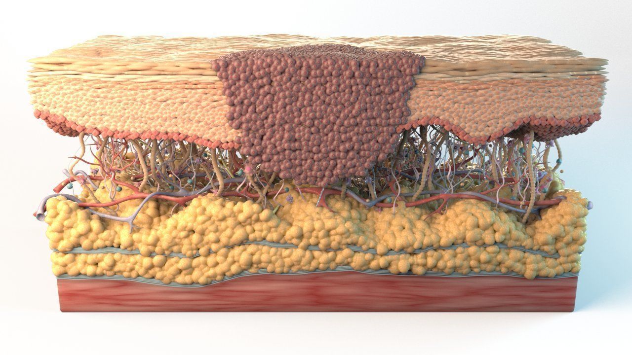 Skin Cancer Cells 3D model_2