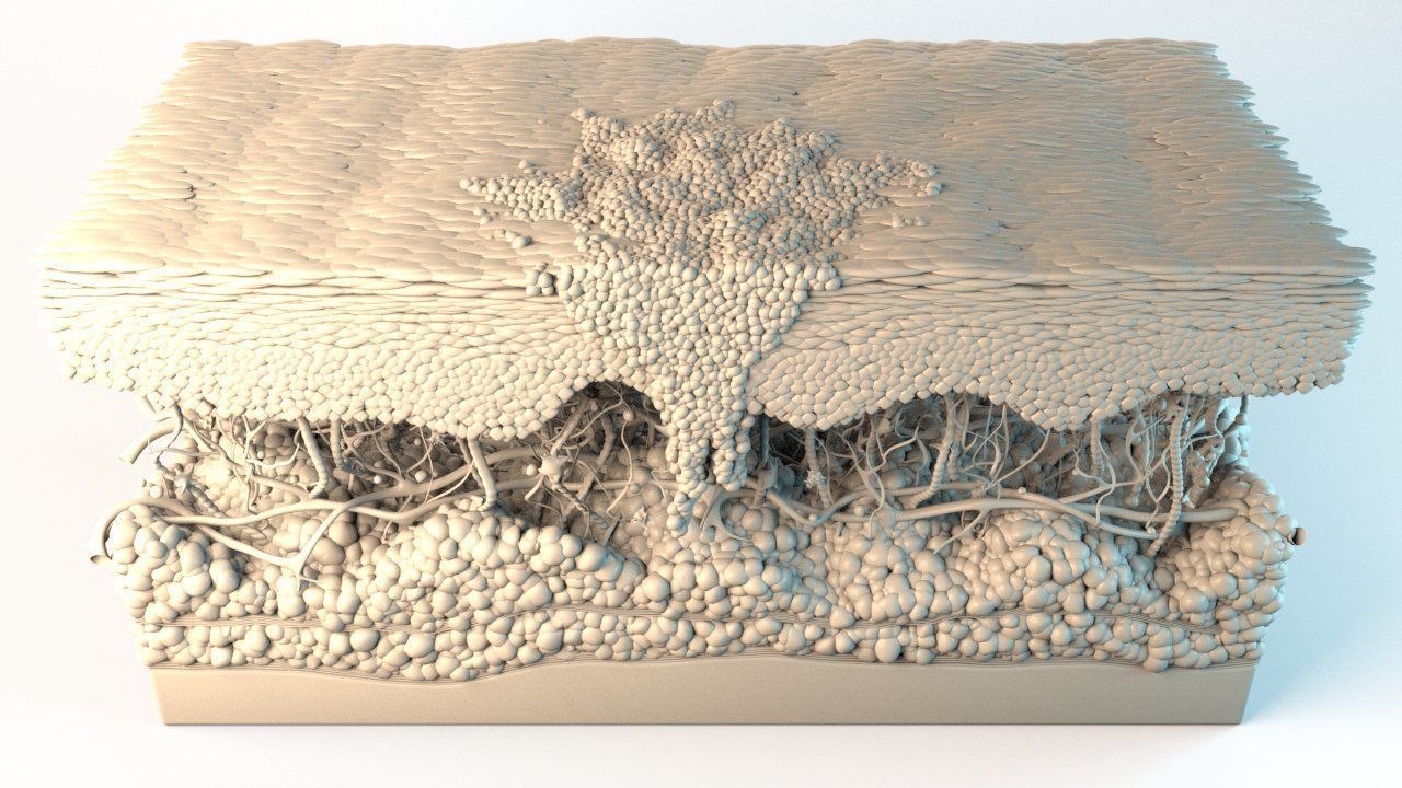 Skin Cancer Cells 3D model_15