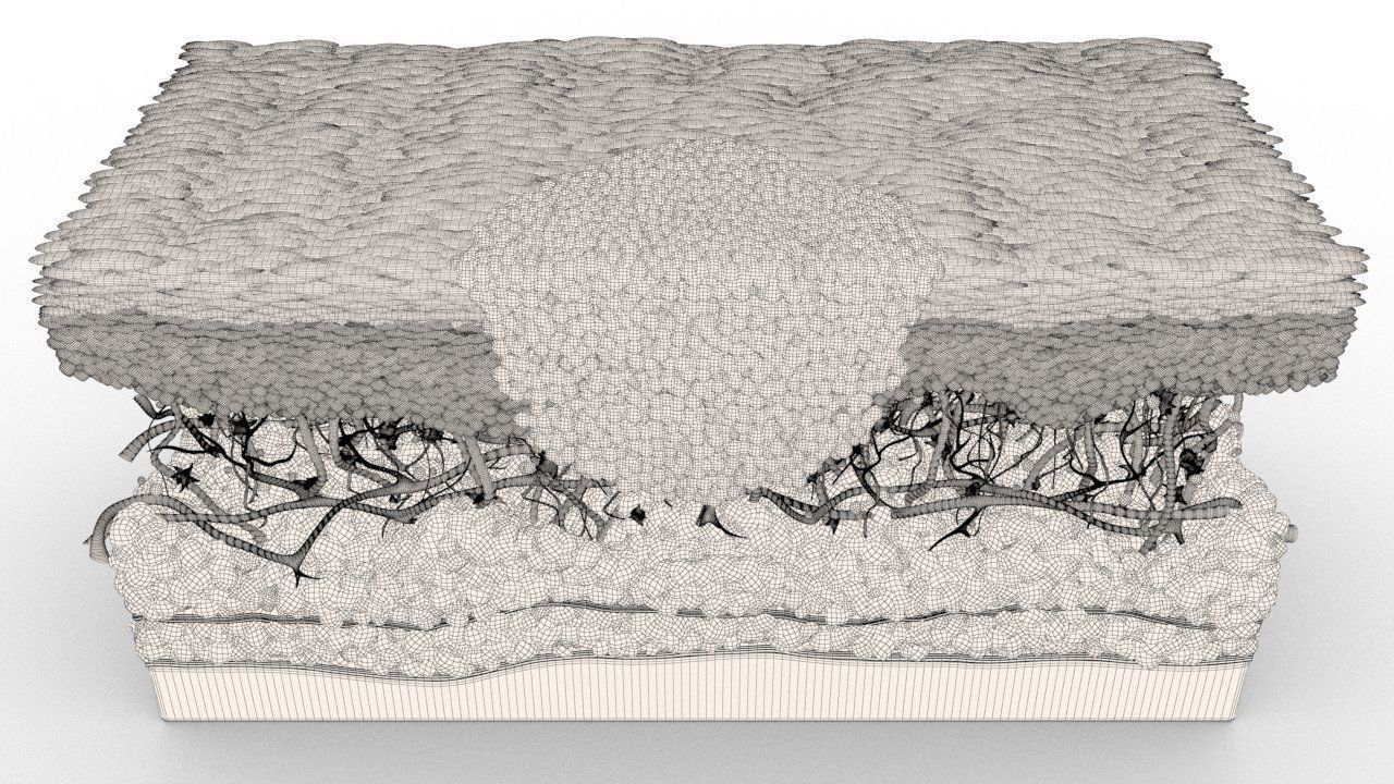 Skin Cancer Cells 3D model_11