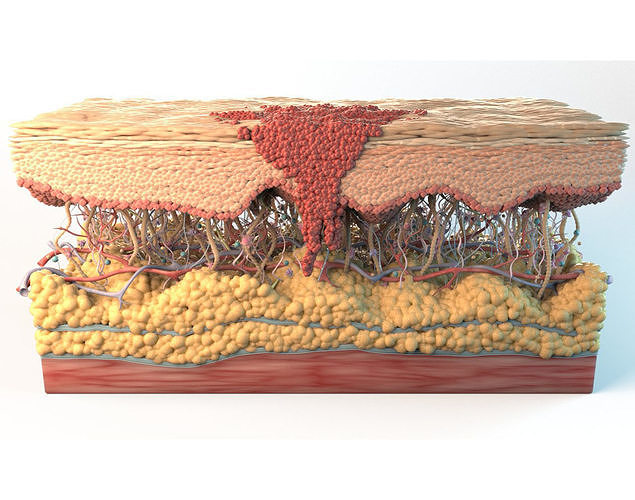 Skin Cancer Cells 3D model