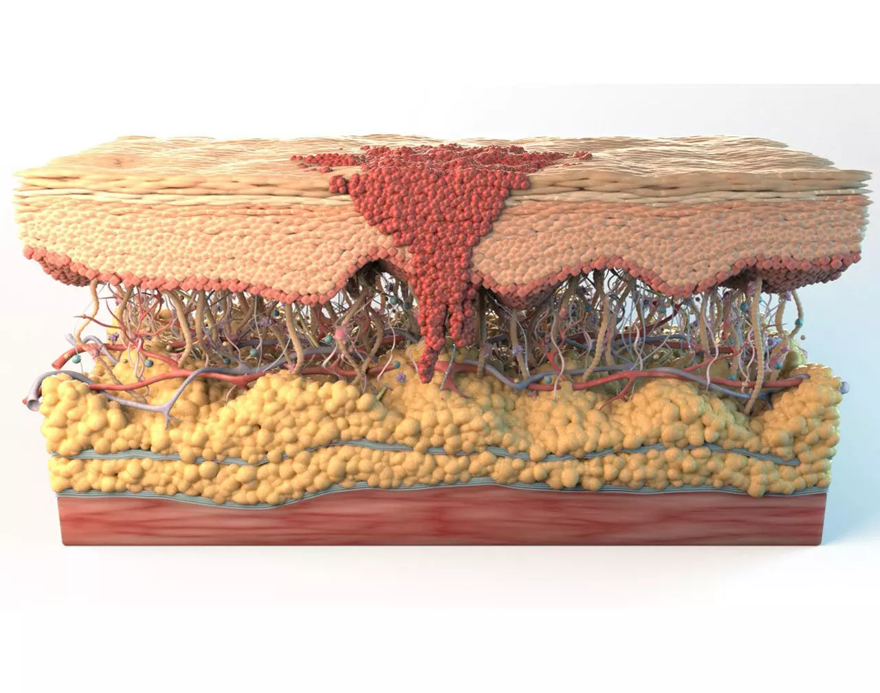 Skin Cancer Cells 3D model_0
