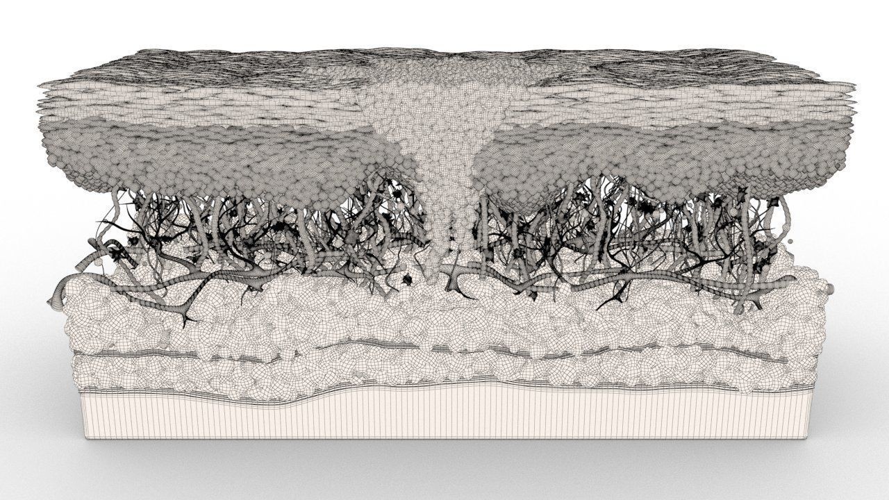 Skin Cancer Cells 3D model_16