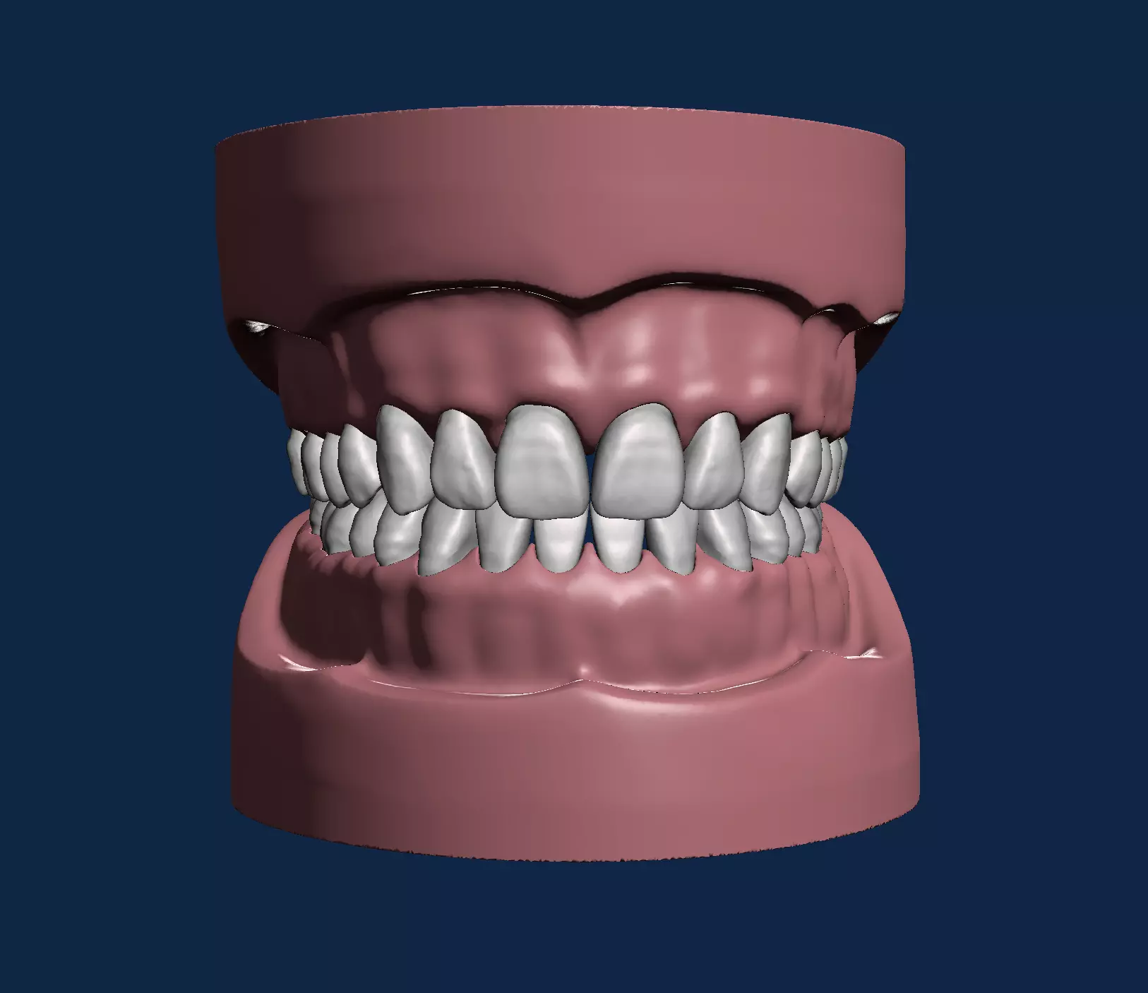 D003 Dental model with natural anatomy typodonts 3D print model