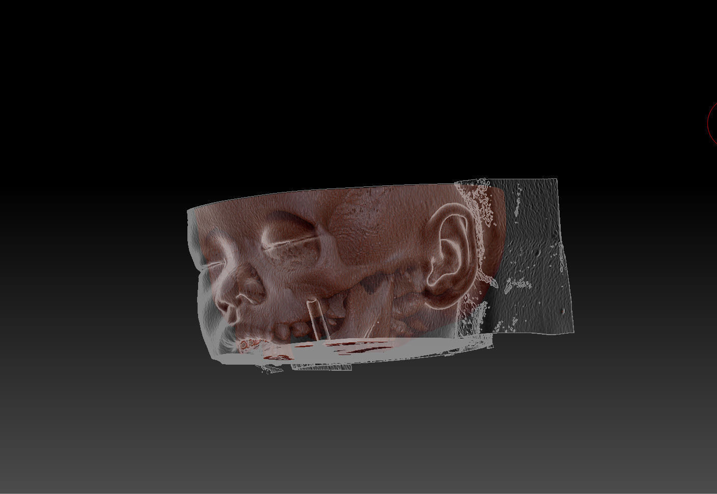 SKULL-Skin MRI  3D print model_4