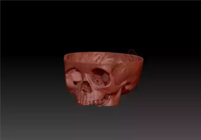 SKULL-Skin MRI 