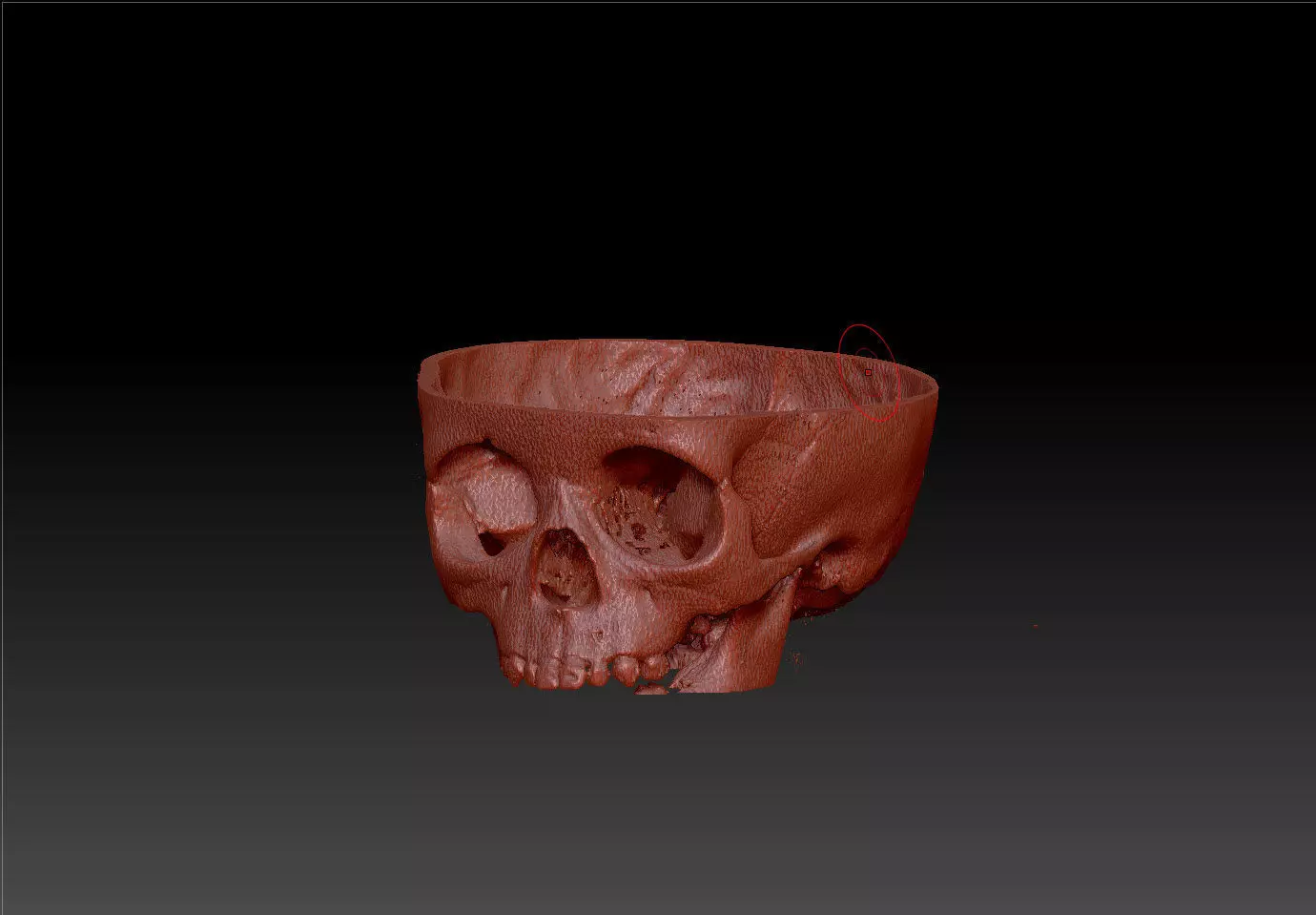SKULL-Skin MRI  3D print model_0