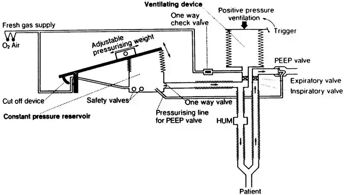 Ventilator PEEP valve Free 3D print model
