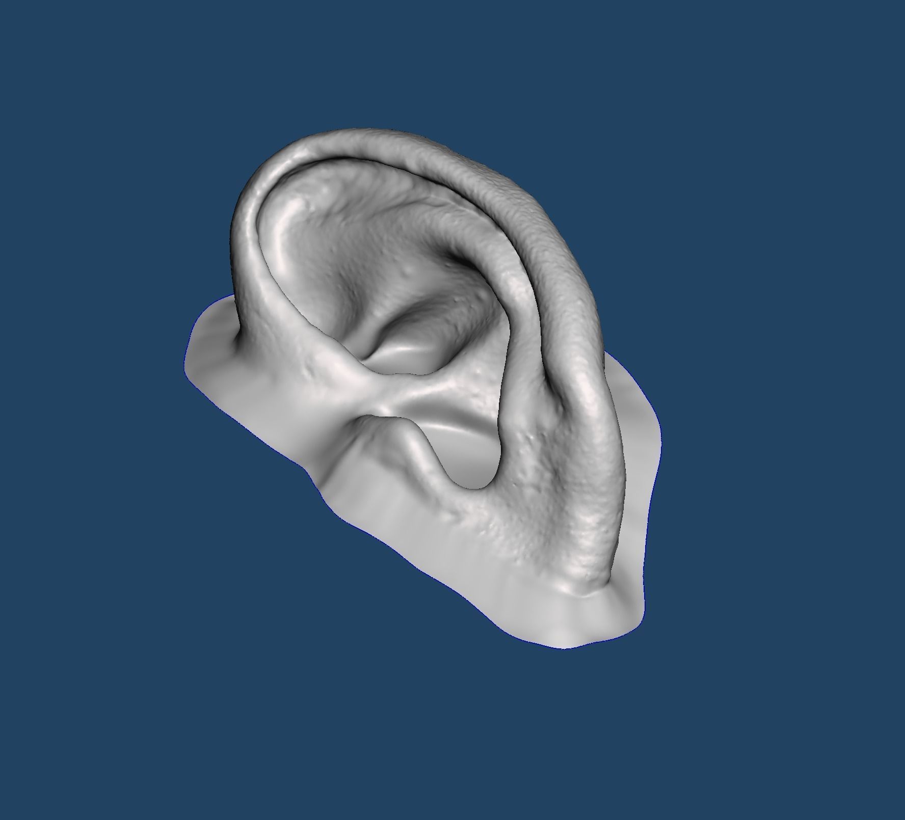 3D print mold for ear silicone prosthesis 3D print model_4