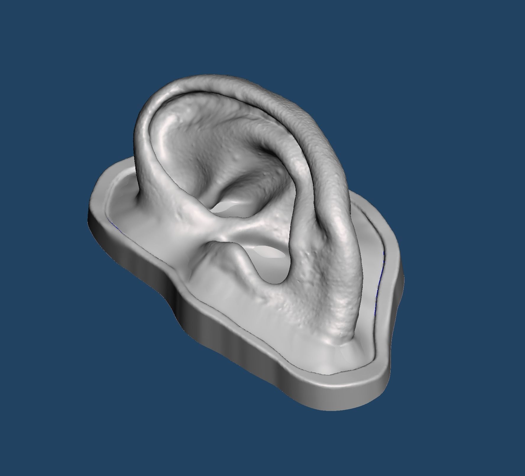 3D print mold for ear silicone prosthesis 3D print model_3