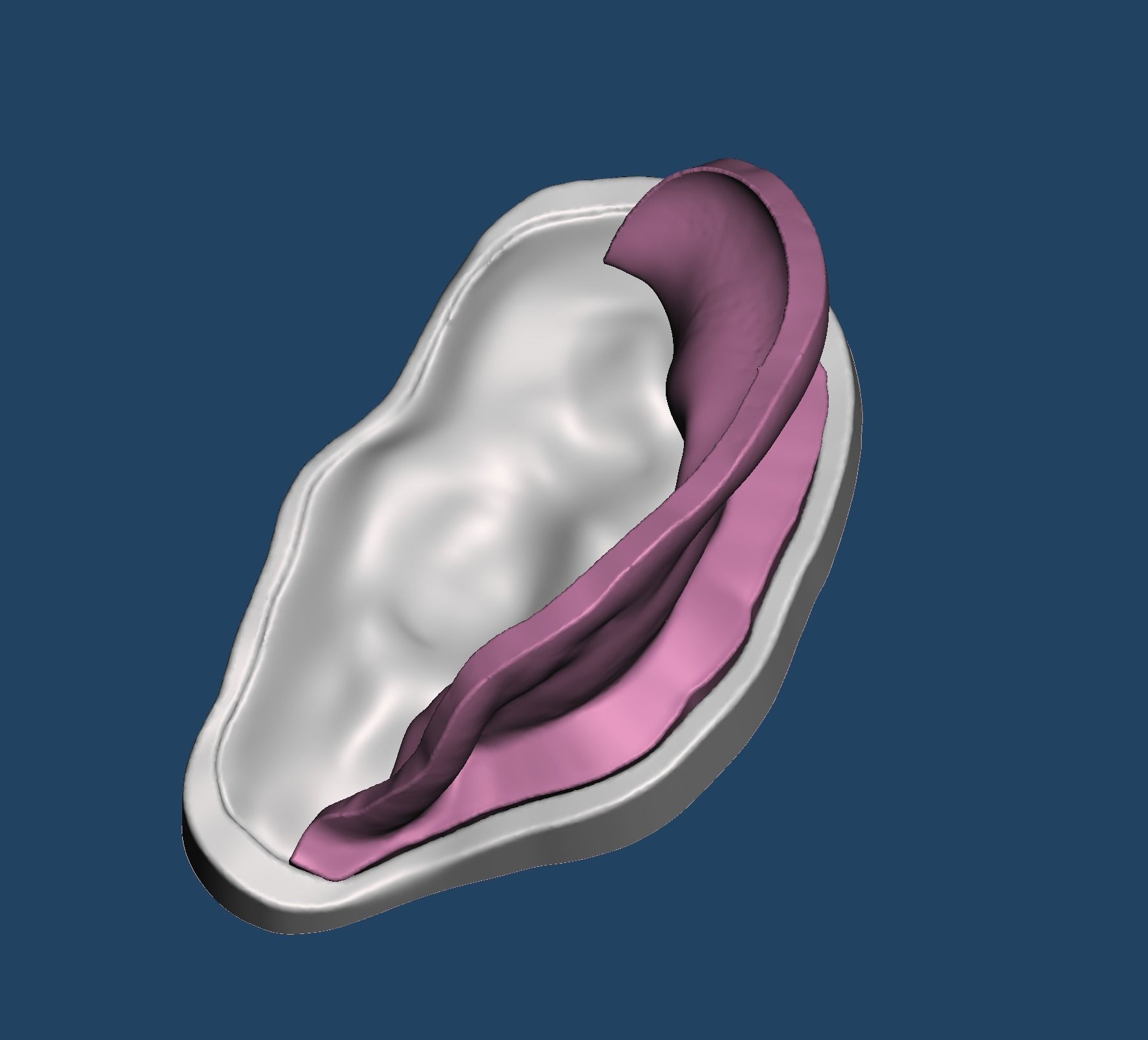 3D print mold for ear silicone prosthesis 3D print model_2