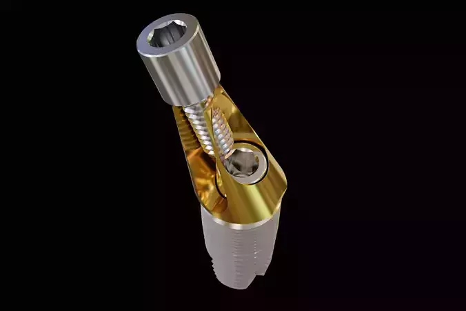Angular abutment and sectional implant 3D model