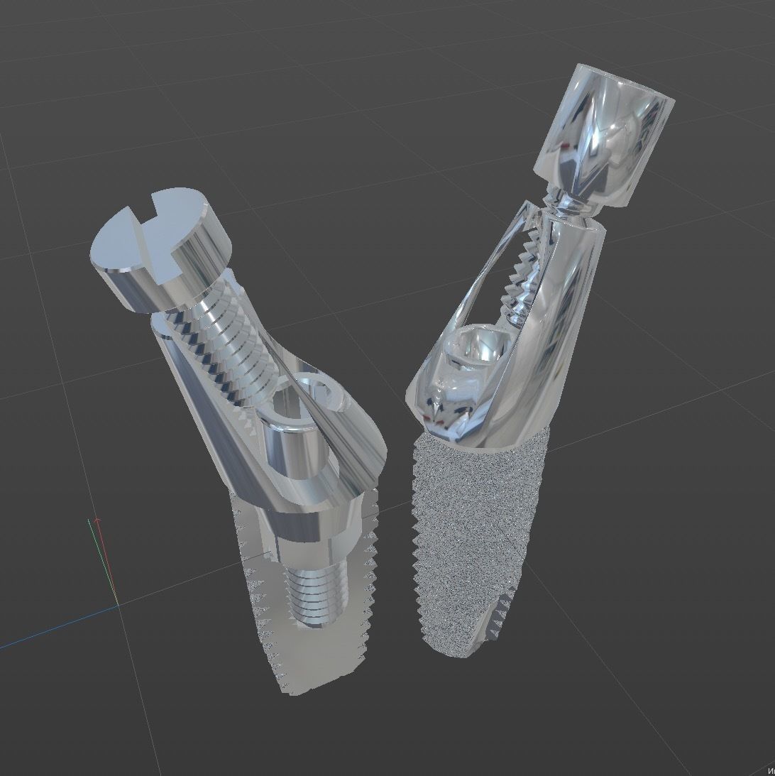 Angular abutment and sectional implant 3D model_6