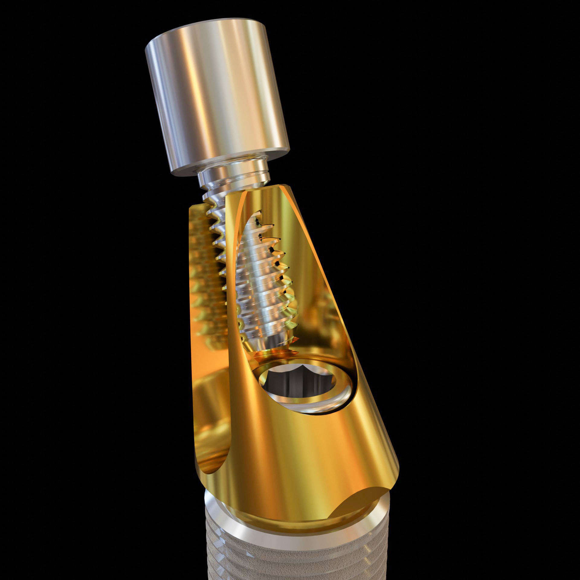 Angular abutment and sectional implant 3D model_3