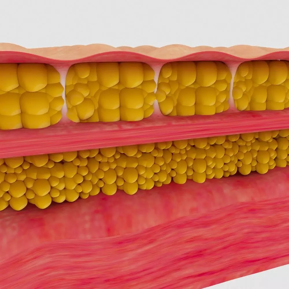 cellulite mattress 3D model_0