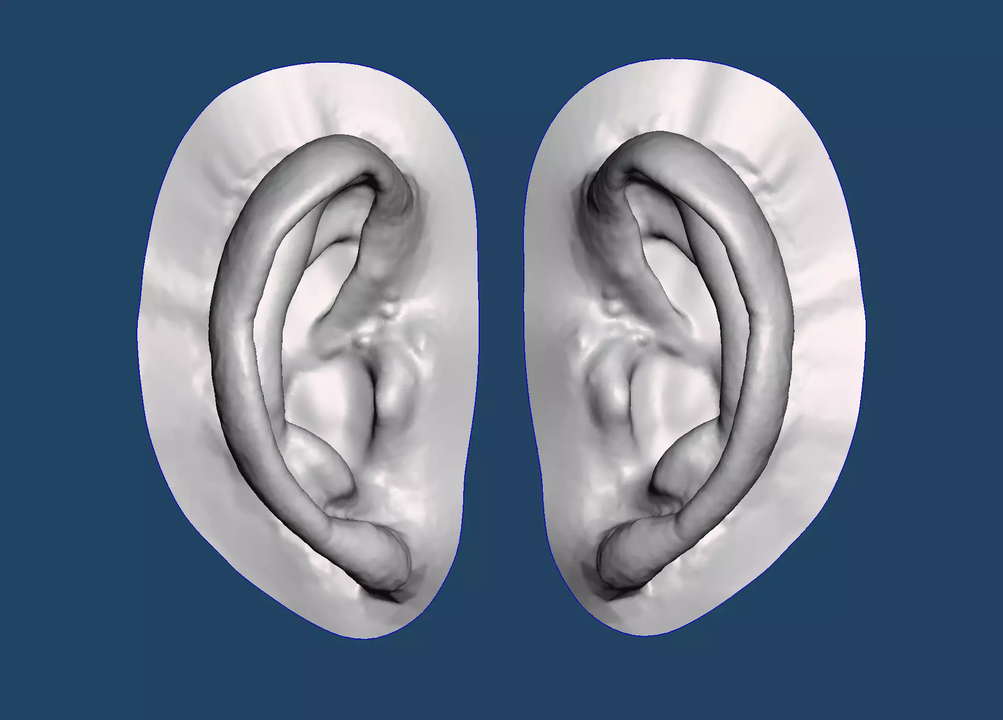 Natural human ear anatomy 06 3D print model