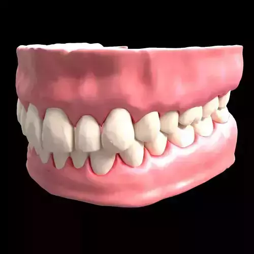 denture dental with teeth and gums 3D model