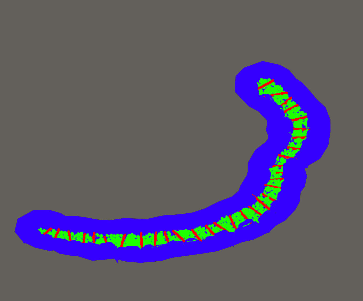 Semi - circular skeleton aisle 01 3D model_1