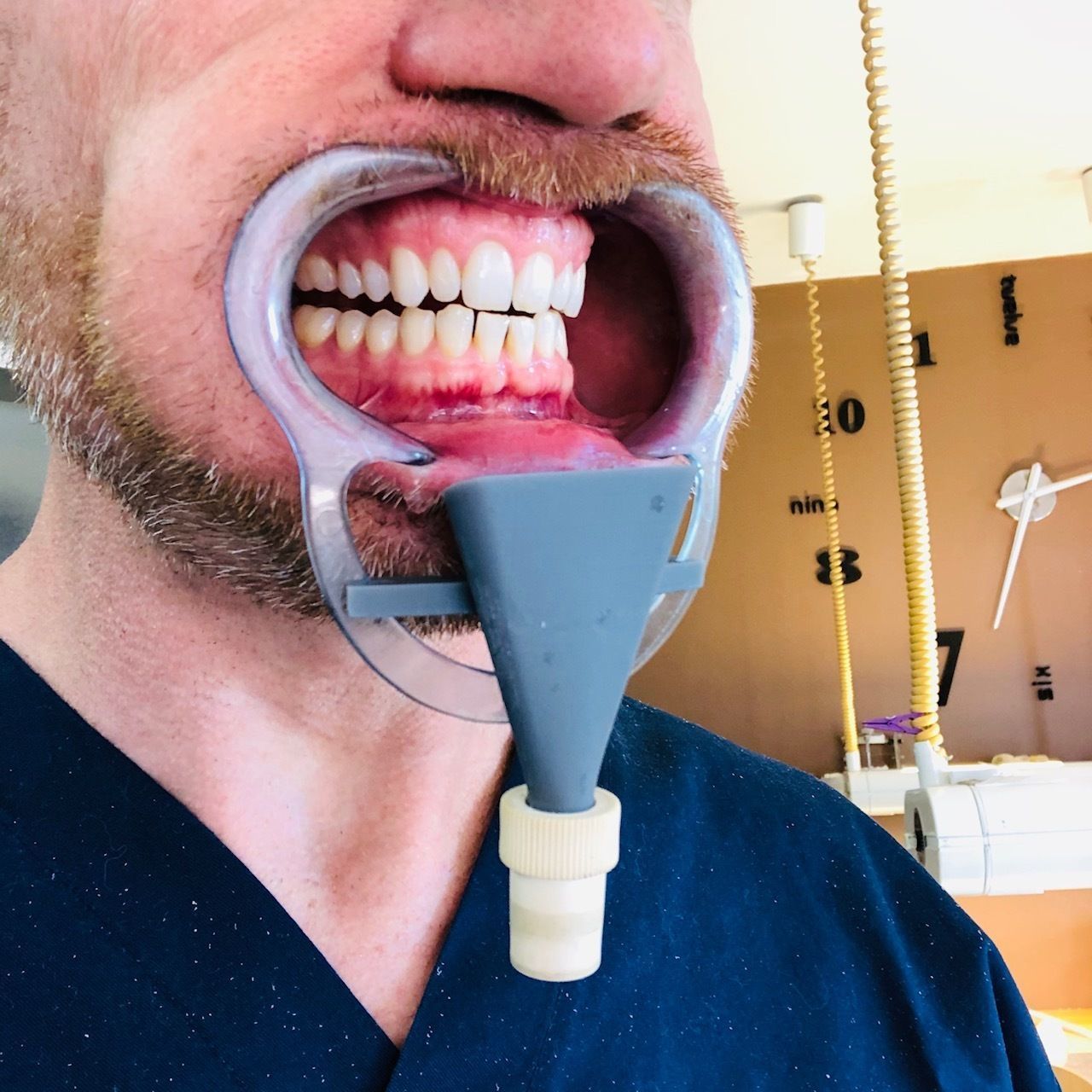 dental suction covid19  3D print model_10