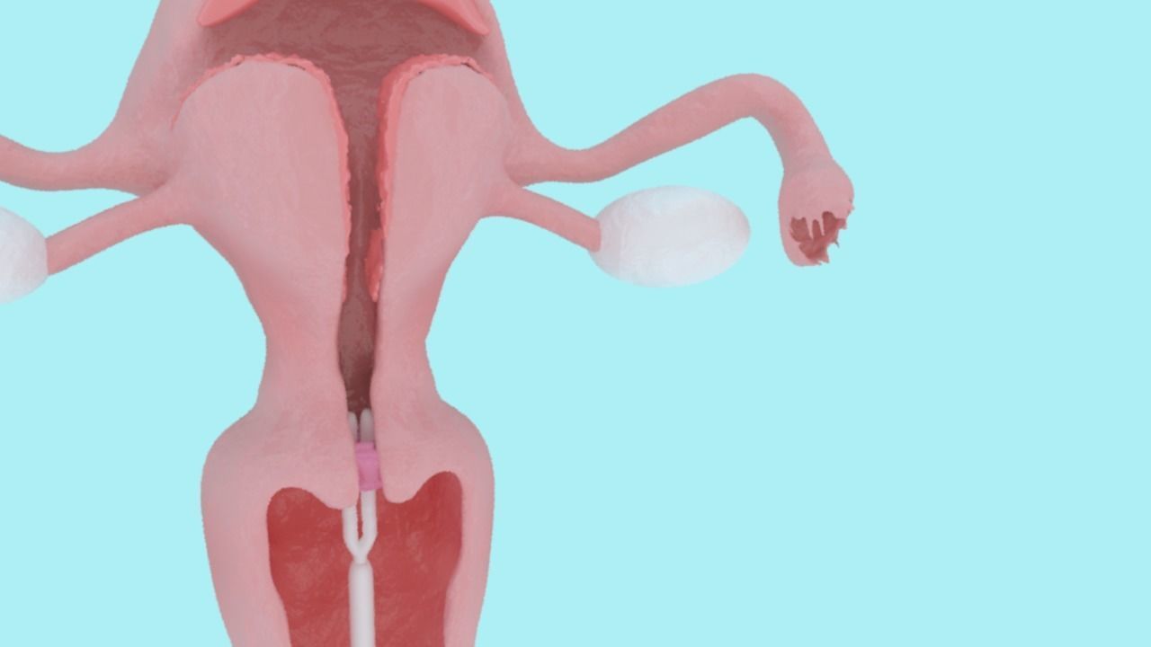 Animated Uterus and Mirena IUD Animable 3D model_2