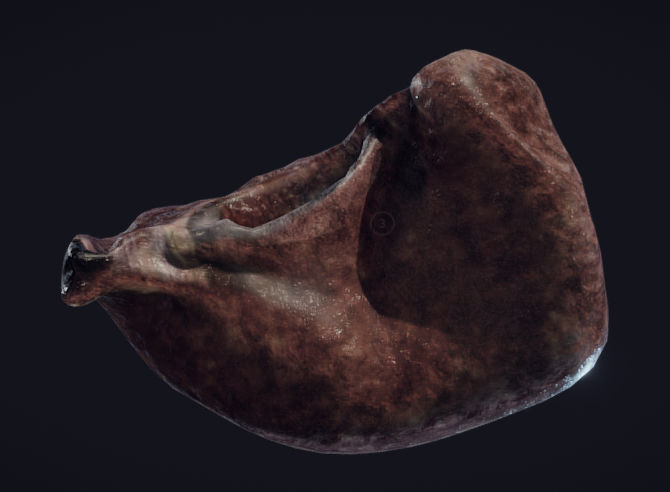 Lung Tuberculosis Low-poly 3D model_8