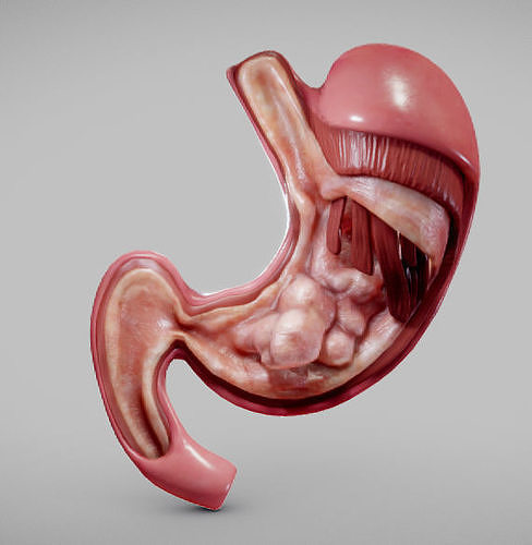 Stomach Cancer Low-poly 3D model