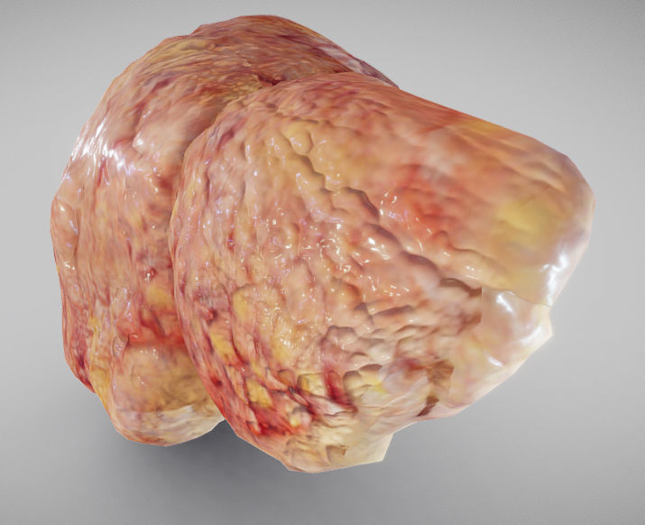 Fatty Liver Low-poly 3D model_10